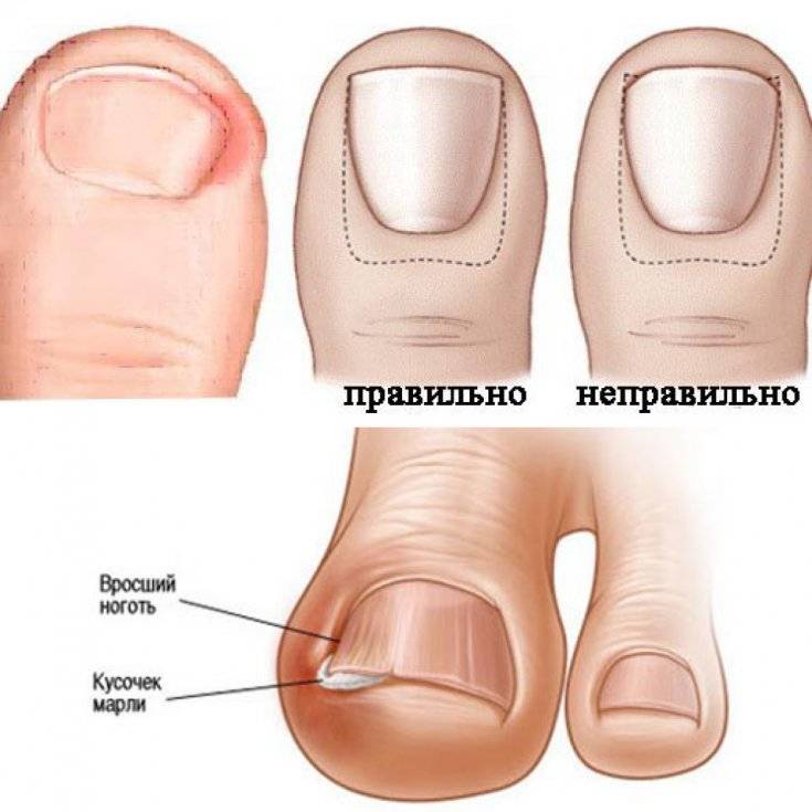 Формы ногтей для маникюра: разновидности, названия и фото