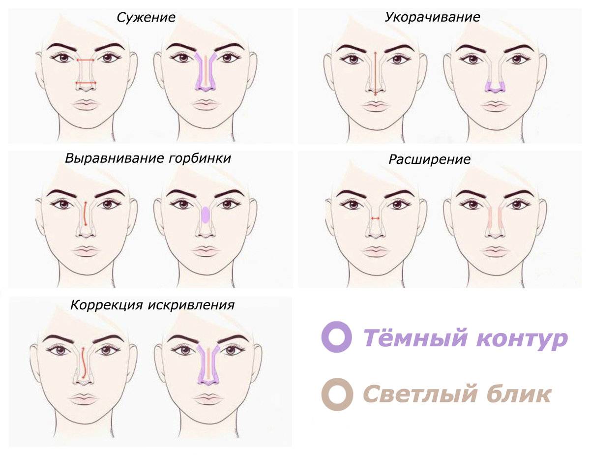 Как скорректировать нос различной формы