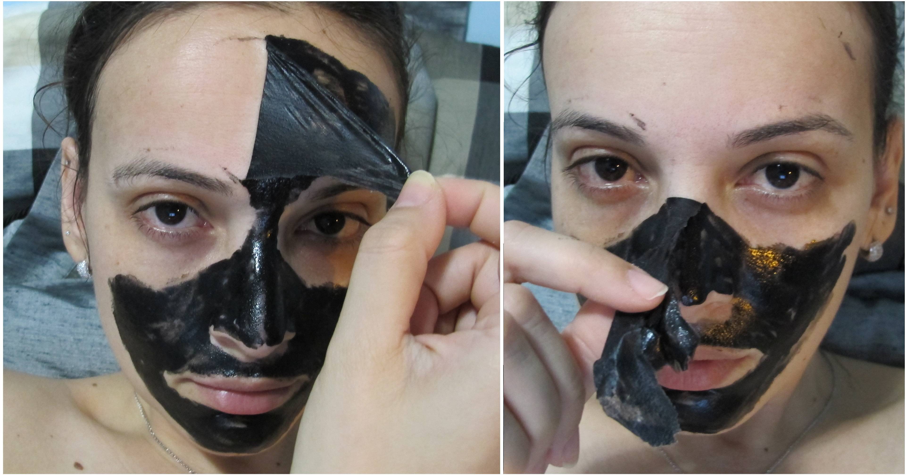 5 масок от черных точек в домашних условиях, которые стоит попробовать