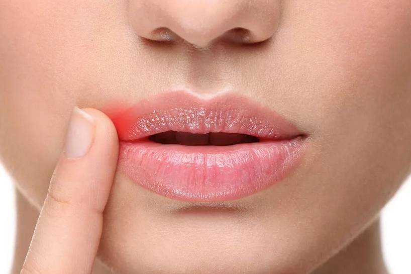 Как увлажнить губы - советы и процедуры для губ - косметология доктора корчагиной