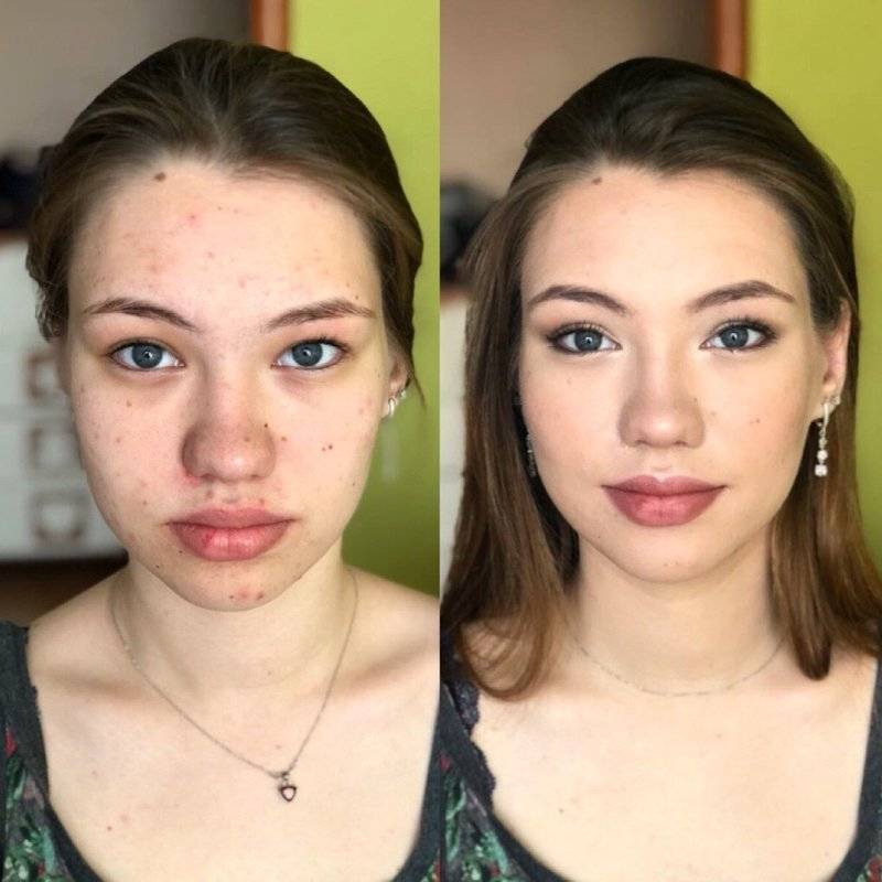 Как сделать макияж для проблемной кожи, чтобы не навредить ей: маленькие секреты умелого визажа