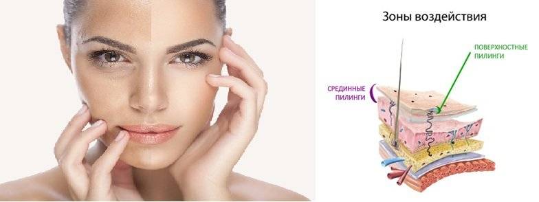 Пилинги в косметологии — эффективное очищение кожи