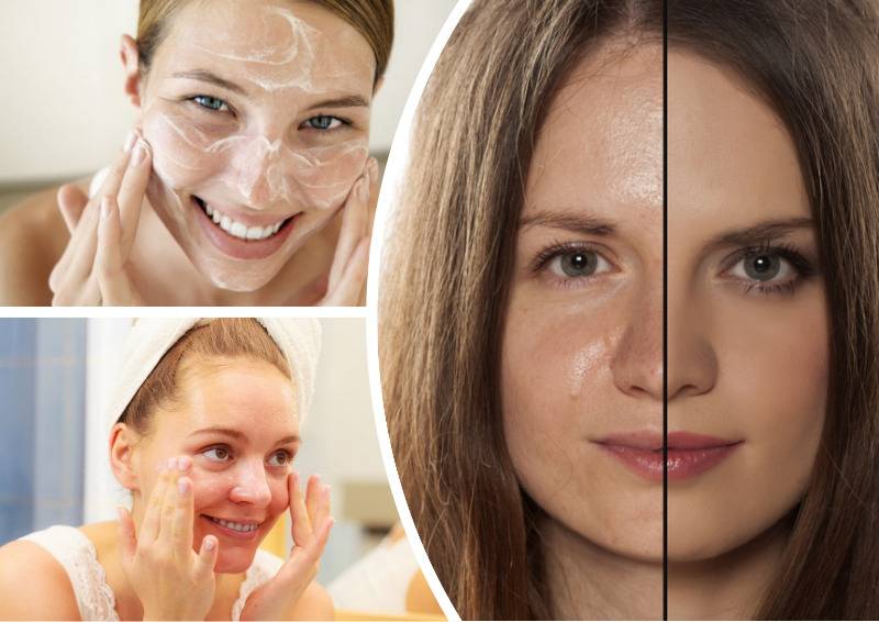 Жирная кожа лица: причины, как ухаживать, как избавиться, рецепты масок, обзор лучшей косметики