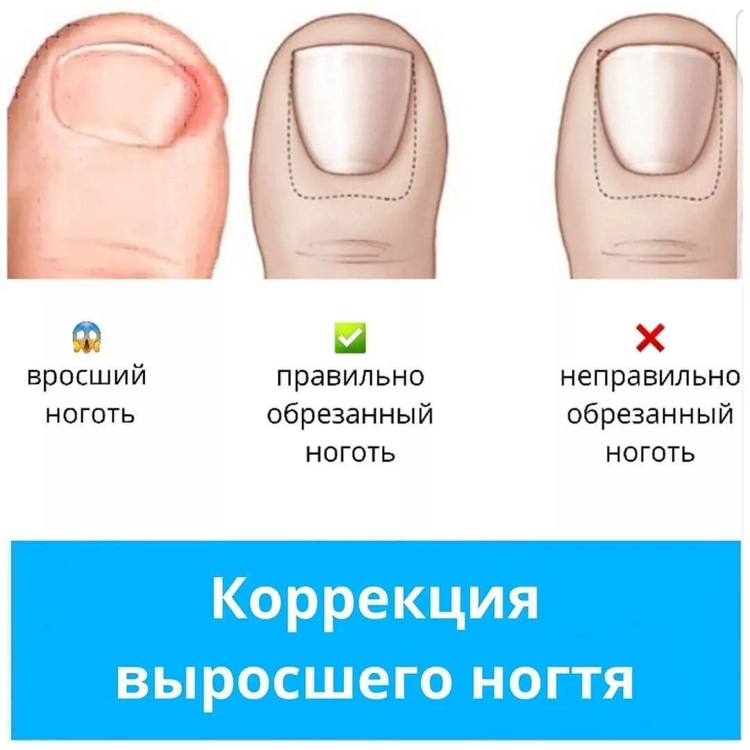 Как правильно стричь ногти
