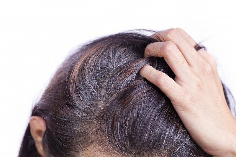 Удаление волос на лице: 10 эффективных средств и процедур