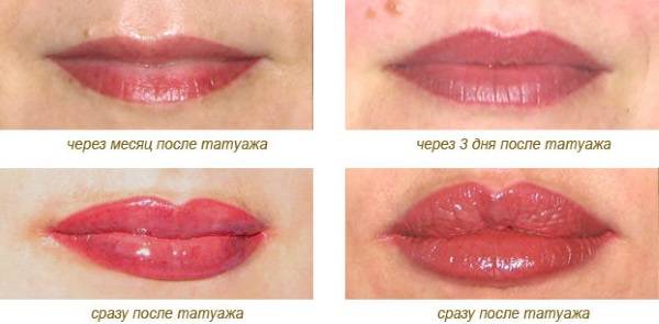 Перманентный макияж губ: подготовка, как делается, уход после, осложнения