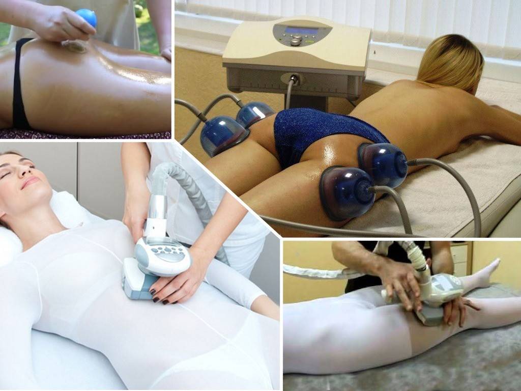 Баночный массаж при остеохондрозе позвоночника: описание