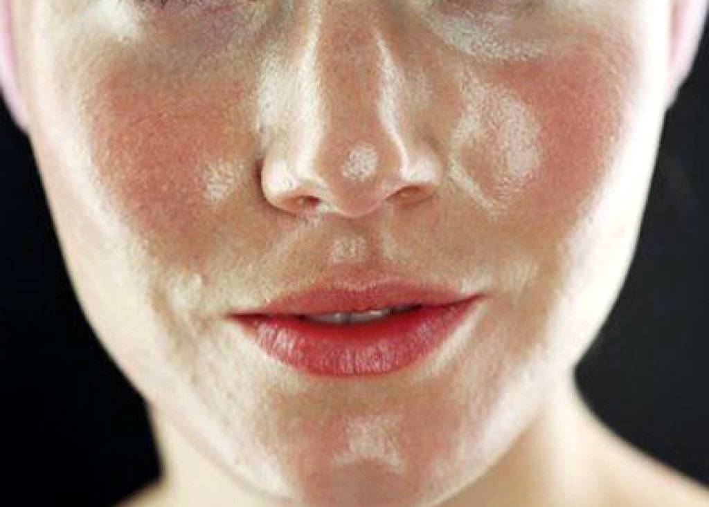 Как избавиться от жирного блеска на лице: топ лайфхаков против жирного блеска