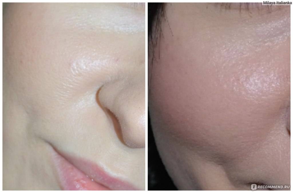 Тональный крем для сухой кожи лица: рекомендации по выбору и обзор лучших средств
