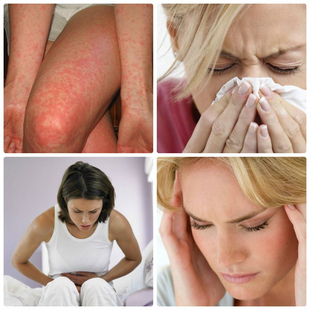 Аллергия на косметику для лица | food and health