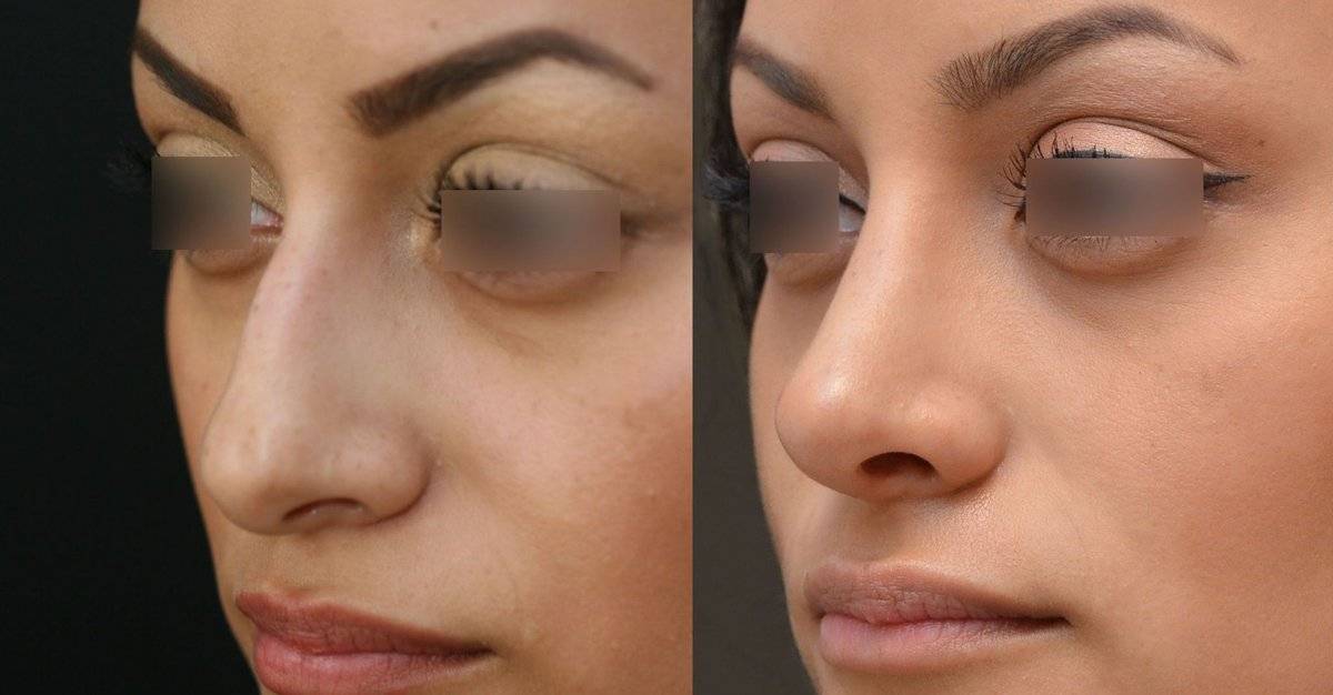 Как визуально уменьшить нос с помощью макияжа: советы и хитрости - леди стиль жизни