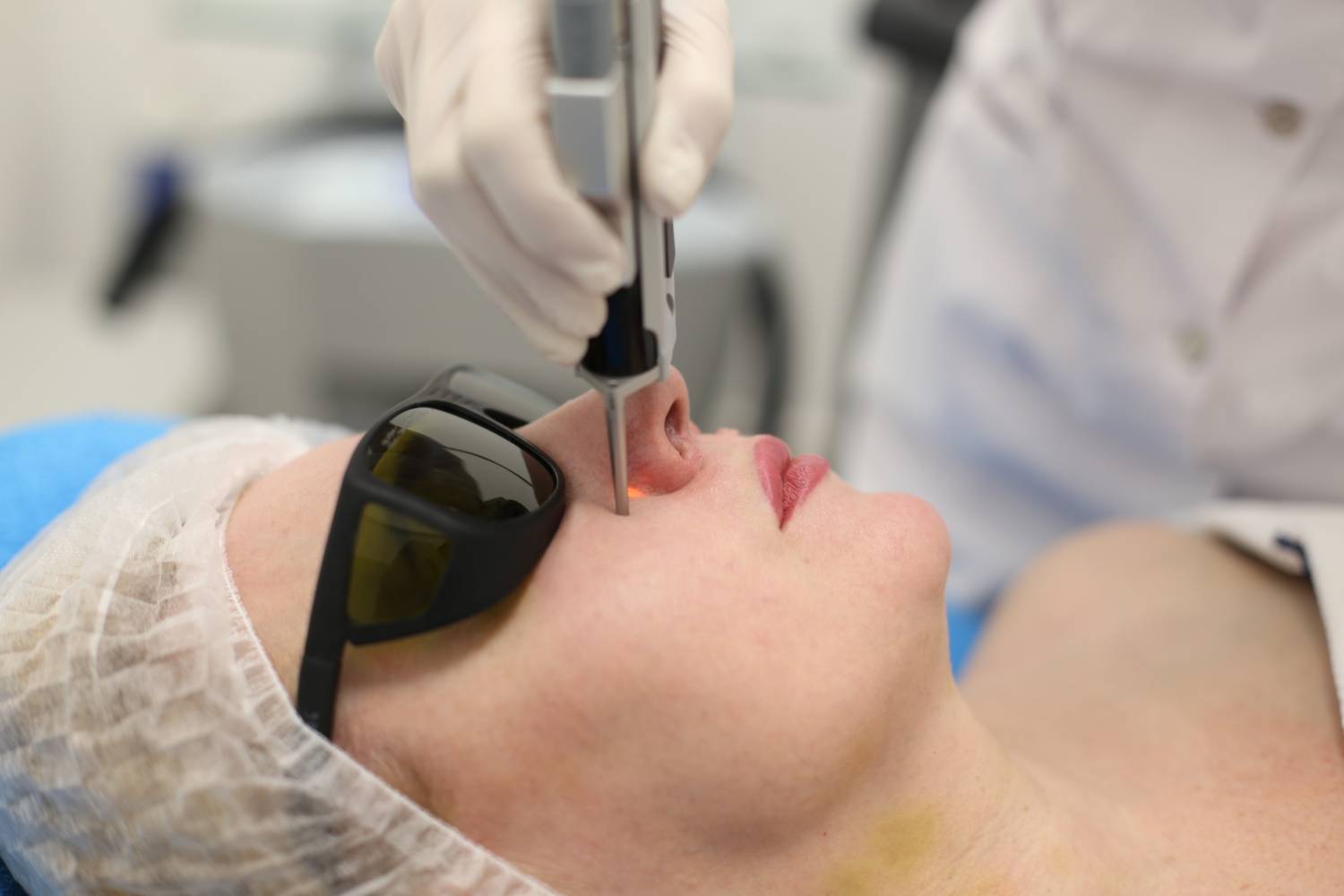 Удаление капилляров на лице: лазерная и ipl технология