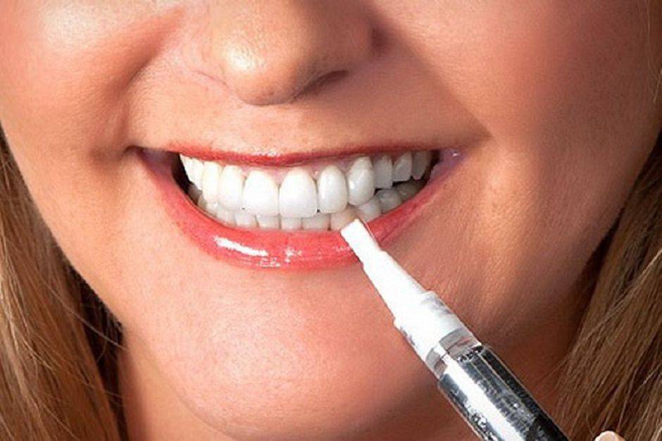 Методы отбеливания зубов  в стоматологии - эффективные способы отбеливания зубов