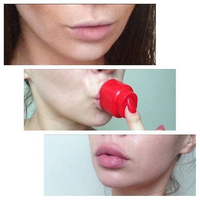 Филлеры для губ – какие из них действительно работают, по мнению косметологов беверли хиллз - клиника косметологии