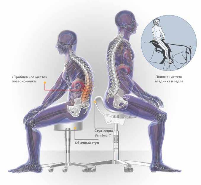 Коленные стулья и стулья-седла — самые безопасные для здоровья позвоночника