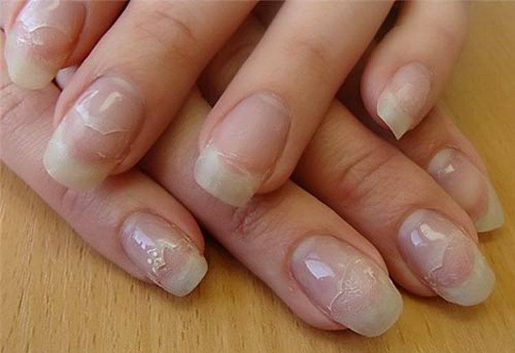 Как вылечить ногти после наращивания гелем? - новая косметология