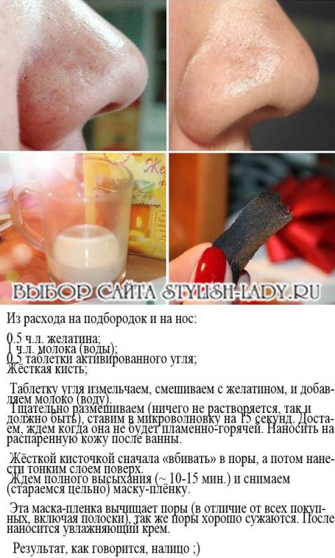 Лицо после механической чистки, противопоказания к ультразвоковой чисте комбинированной кожи лица