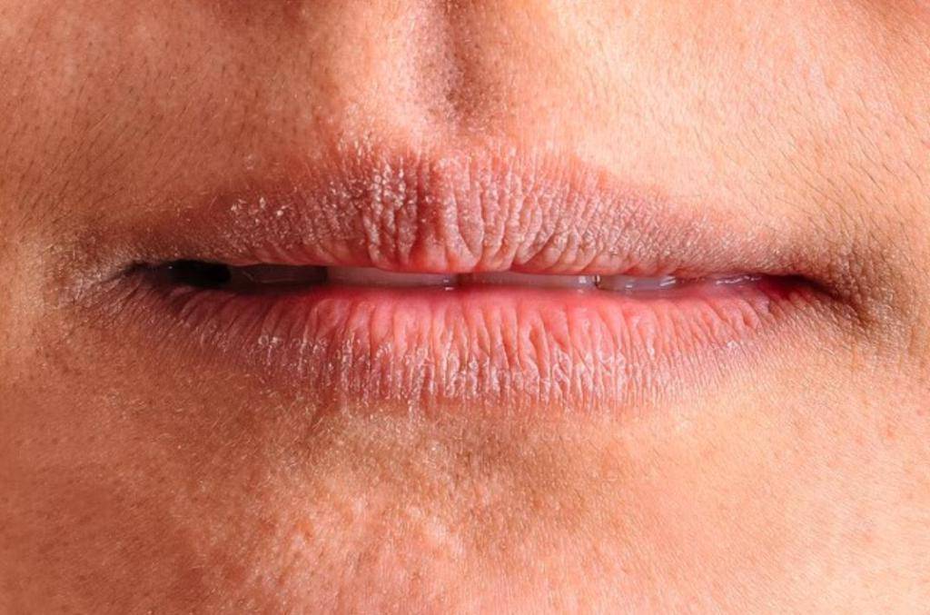 Трещины в уголках рта: причины, лечение | food and health