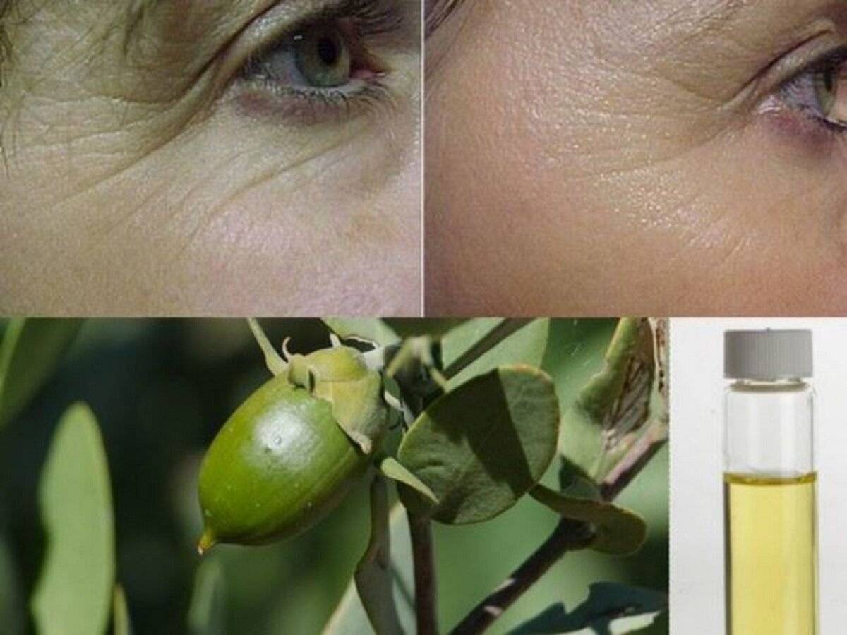 Оливковое масло против морщин на лице, вокруг глаз и на лбу