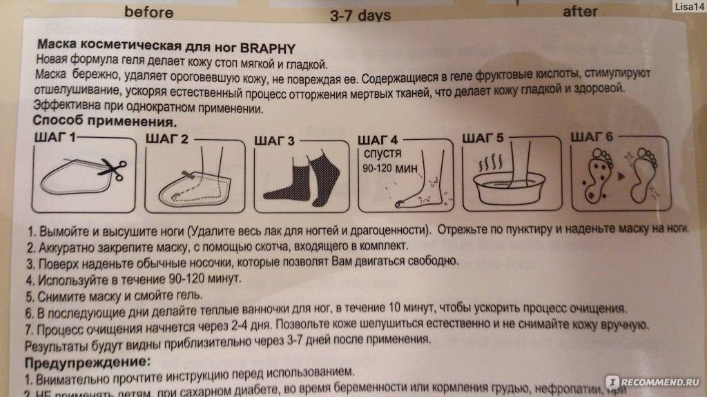 Педикюрные носочки: отзывы. инструкция по применению :: syl.ru