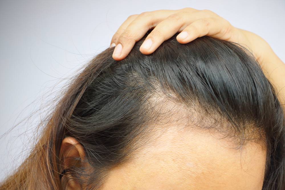 Советы трихолога: правила по уходу за волосами и решение проблем - клиника «доктор волос»