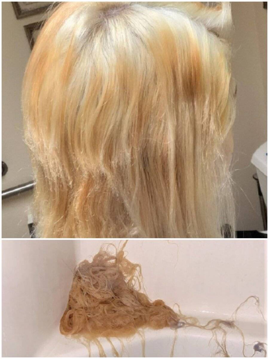 Как осветлить или обесцветить волосы на теле и лице в домашних условиях