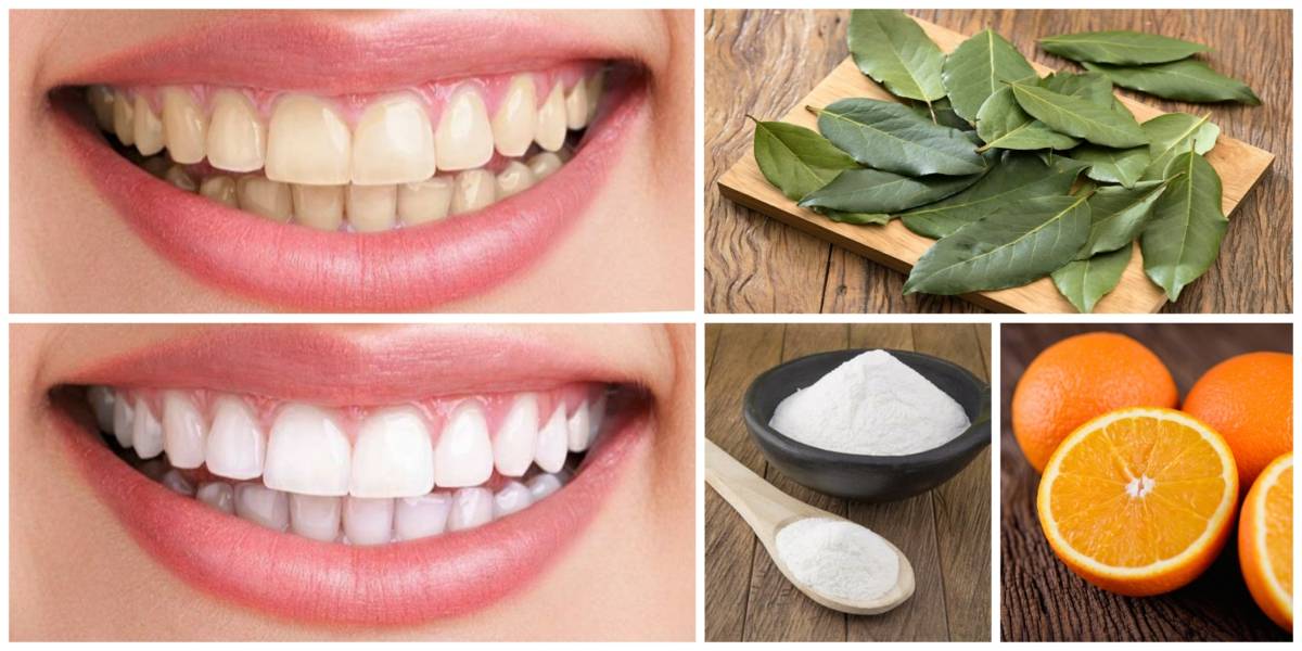 Как отбелить зубы в домашних условиях без вреда для эмали: самые лучшие и эффективные способы