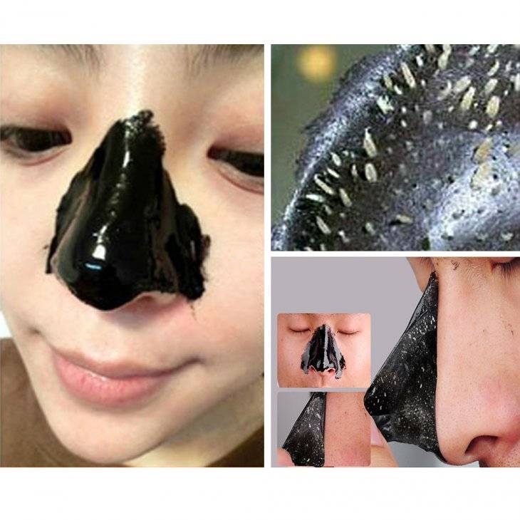 6 рецептов черной маски, которая мгновенно чистит поры