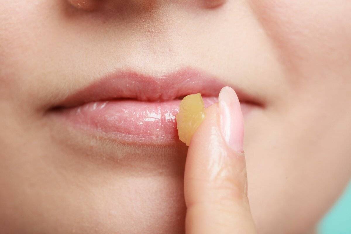 Что делать, если губы постоянно сухие?