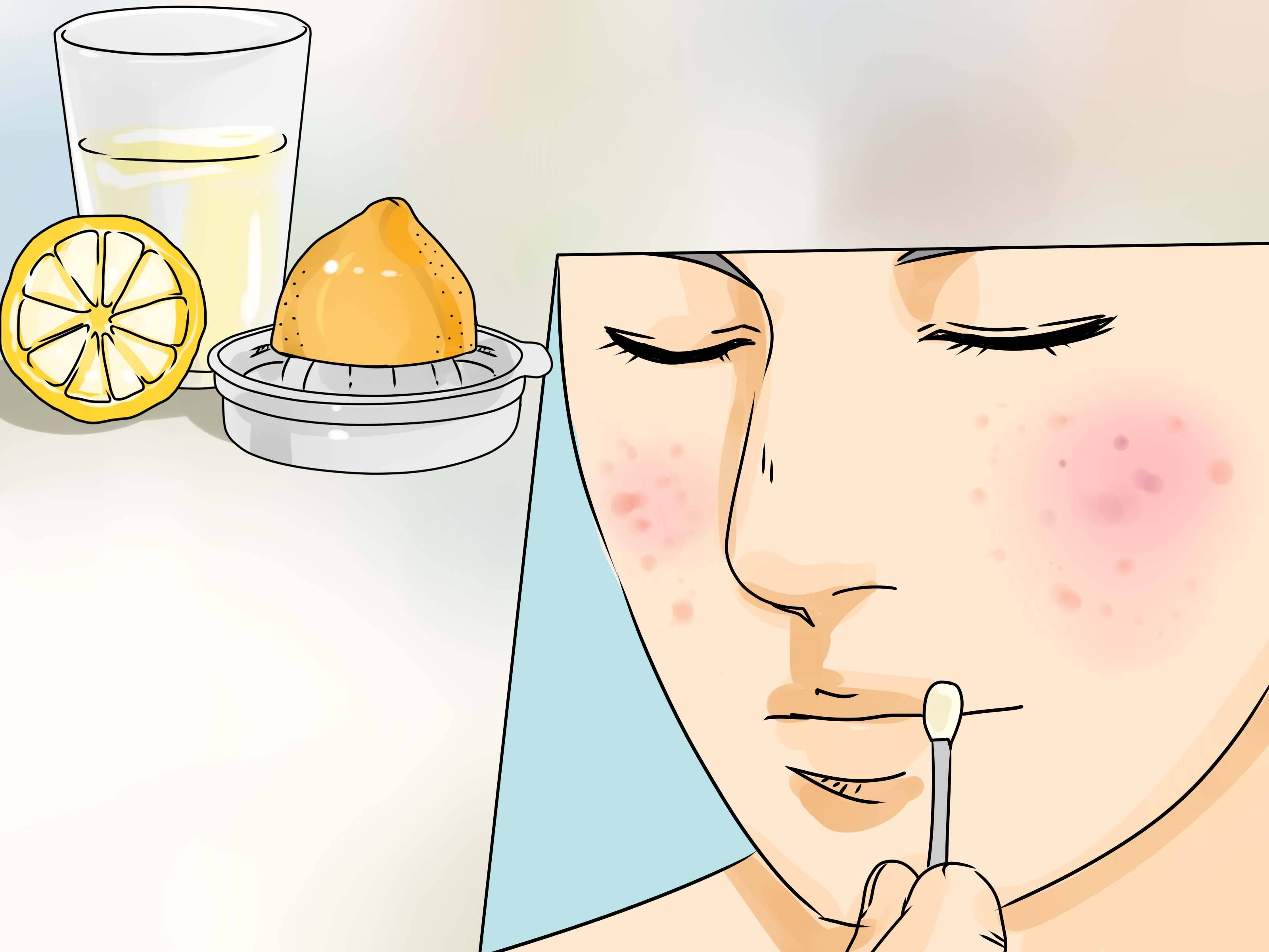 Фурункул, карбункул и абсцесс кожи - лечение | отделение мед услуг