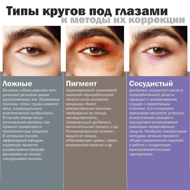 Темные круги вокруг глаз «ochkov.net»