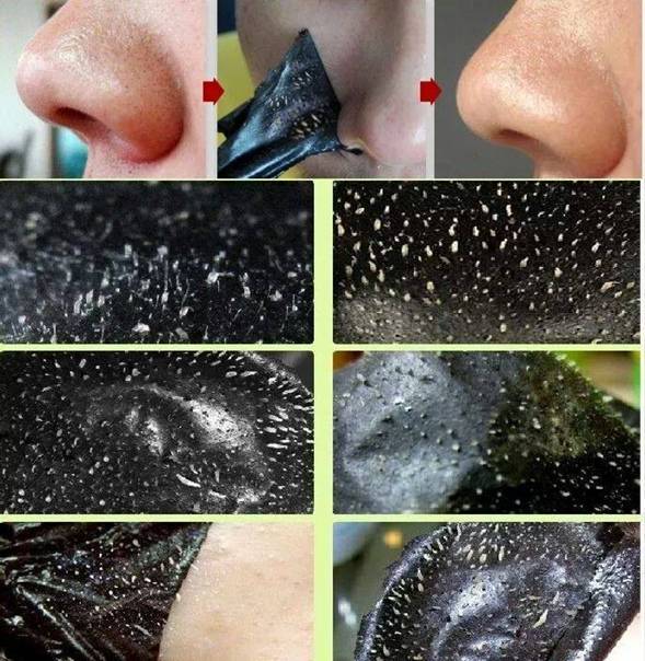 Как сделать черную маску от черных точек в домашних условиях
