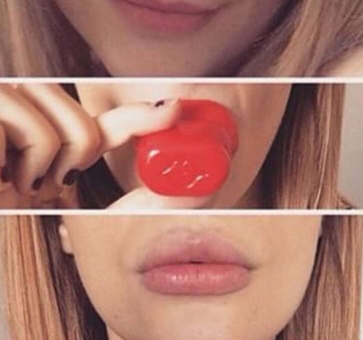 Противопоказания к увеличению губ: в какух случаях не нужно делать увеличение губ (контурную пластику) гиалуроновой кислотой - bellezza