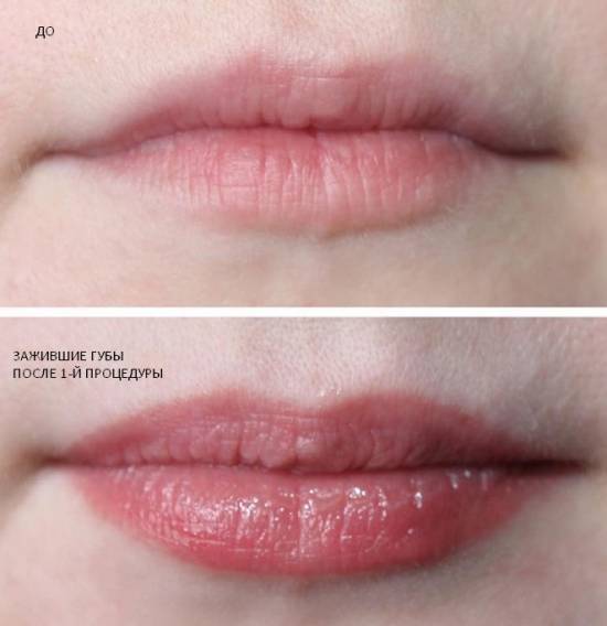 Татуаж губ – все, что нужно знать о процедуре, постпроцедурном уходе и заживлении