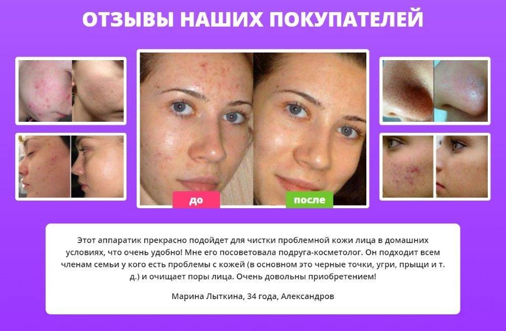 Уз чистка лица – современный ультразвуковой способ борьбы с проблемной кожей