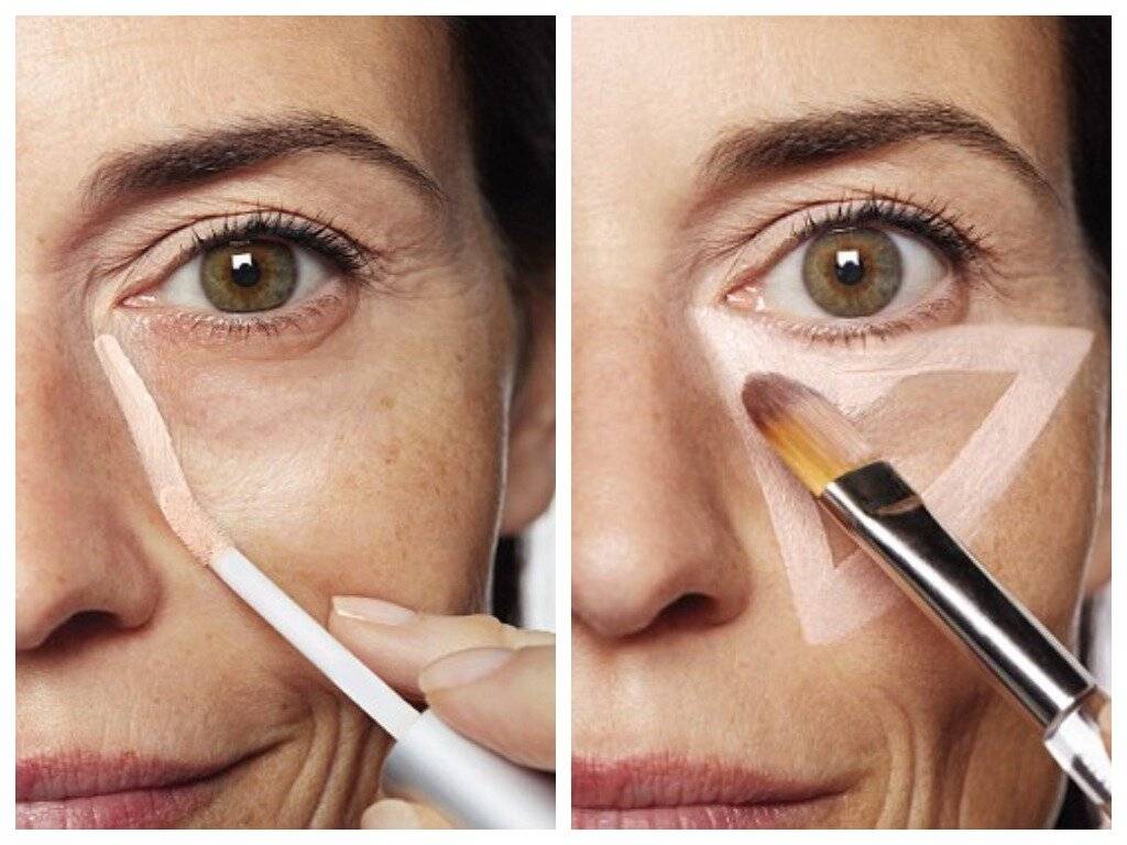 Как замазать синяк на лице. как замаскировать синяк под глазом от удара: косметика, рекомендации и особенности