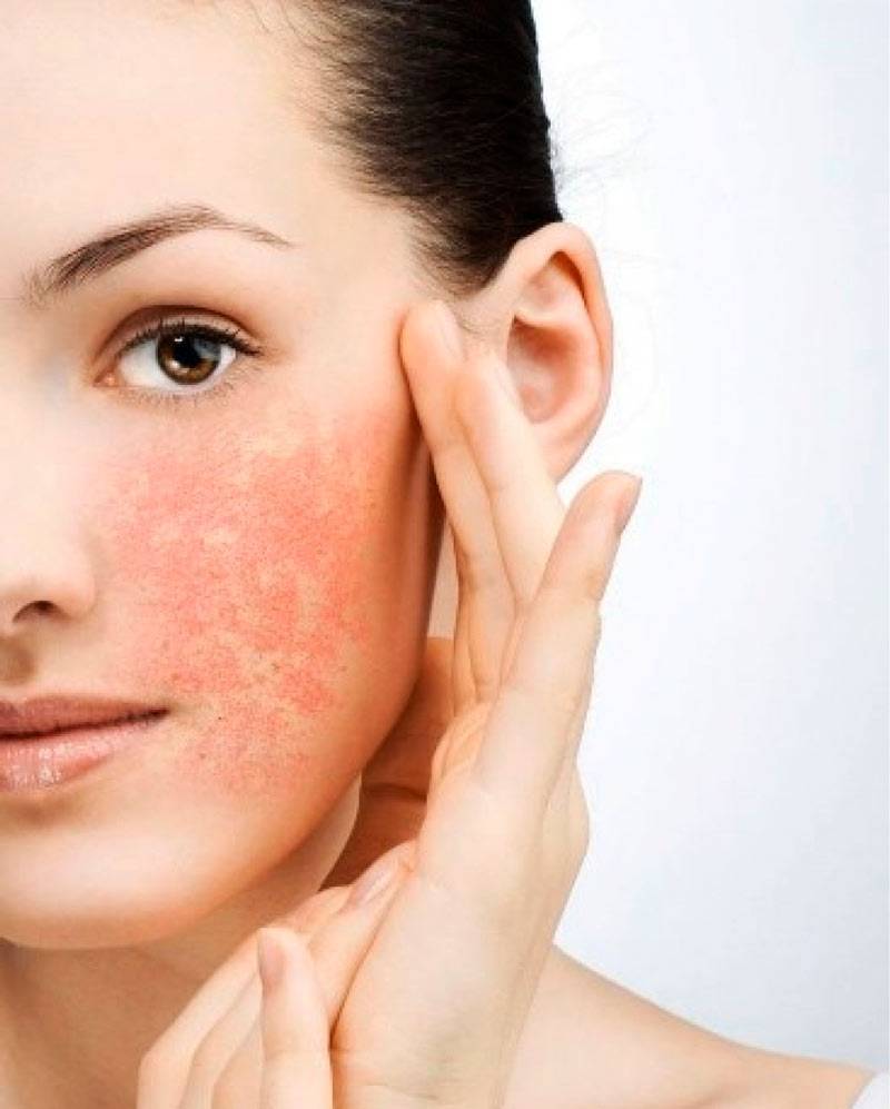 Как правильно увлажнить кожу лица в домашних условиях, чем лучше увлажнять кожу - top100beauty