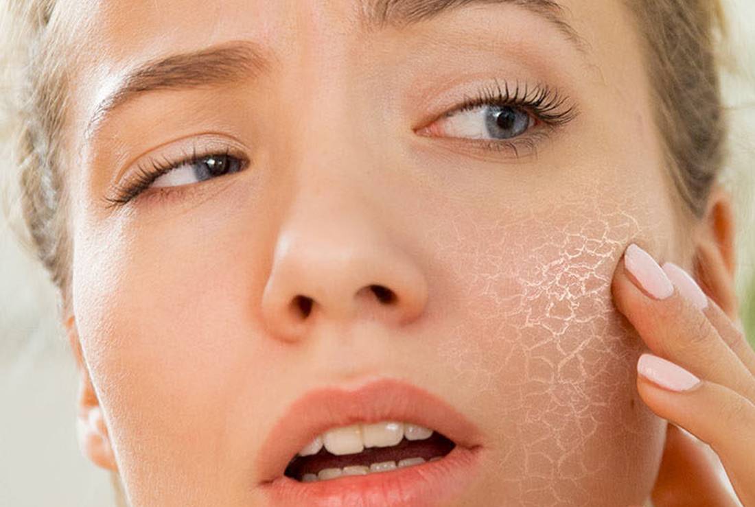 Как увлажнить сухую кожу лица в домашних условиях