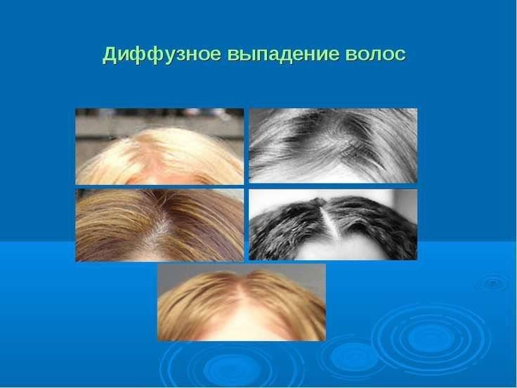 Аптечные средства против выпадения волос - список самых эффективных средств