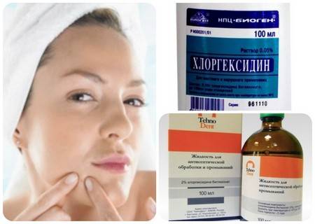 Хлоргексидин от прыщей: можно ли протирать лицо? помогает ли? | moninomama.ru