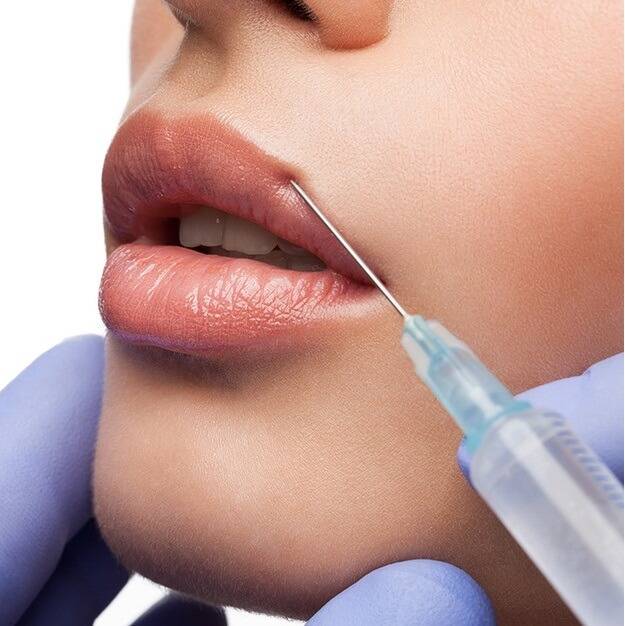 Способы выведения гиалуроновой кислоты из губ