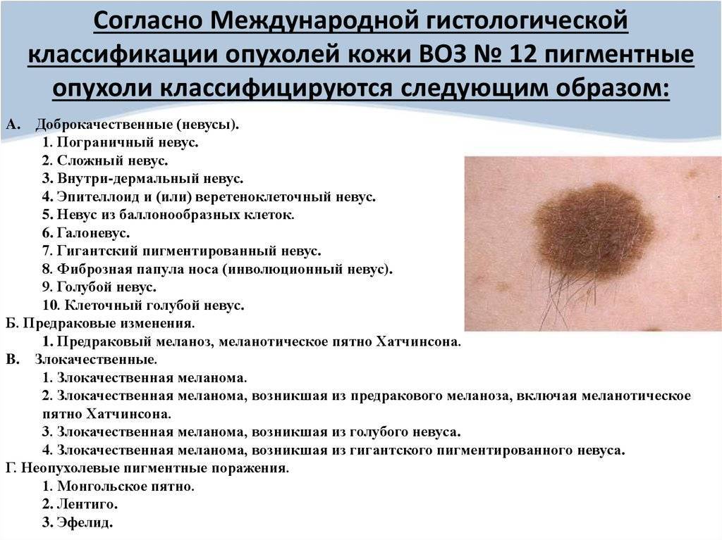 Вирусные заболевания кожи — симптомы, диагностика и методы лечения | альтермед
