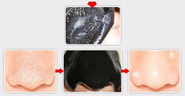 Пластырь от черных точек: альтернативное и безболезненное очищение кожи в домашних условиях