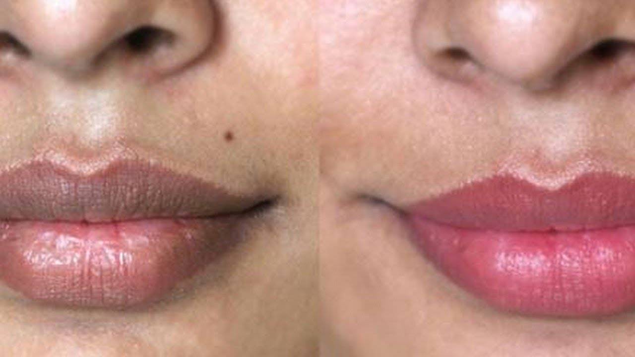 Как осветлить темные губы в домашних условиях?