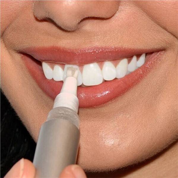 Отбеливание зубов – польза или вред?