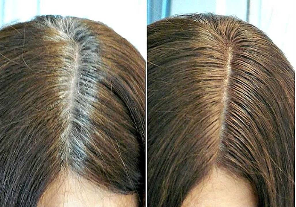 Как отрастить седые волосы после окрашивания