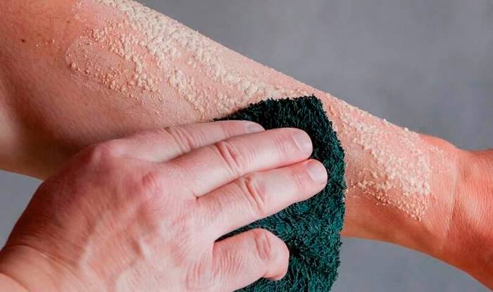 Что делать с дряблой кожей после похудения? ✔️ блог клиники лица