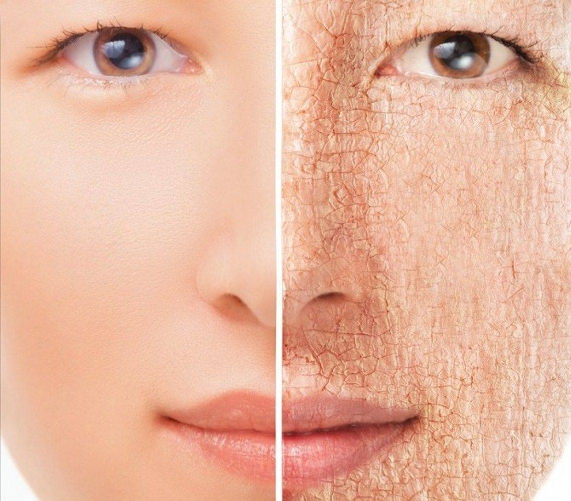 Шелушится кожа на лице: причины и как убрать шелушение с поомщью кремов, витаминов и скрабов