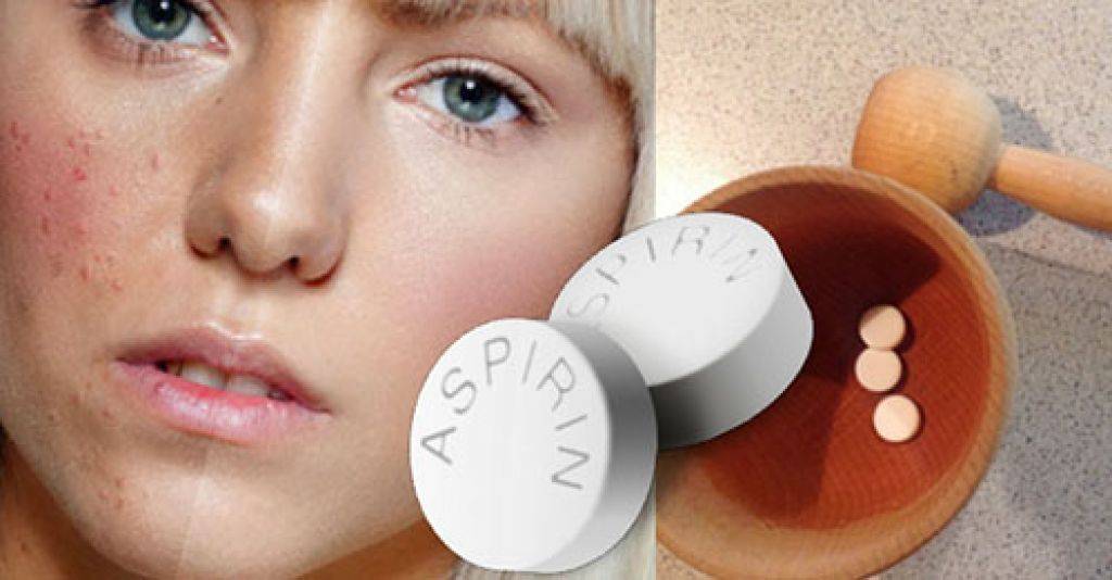 Аспирин против прыщей на лице — способ применения