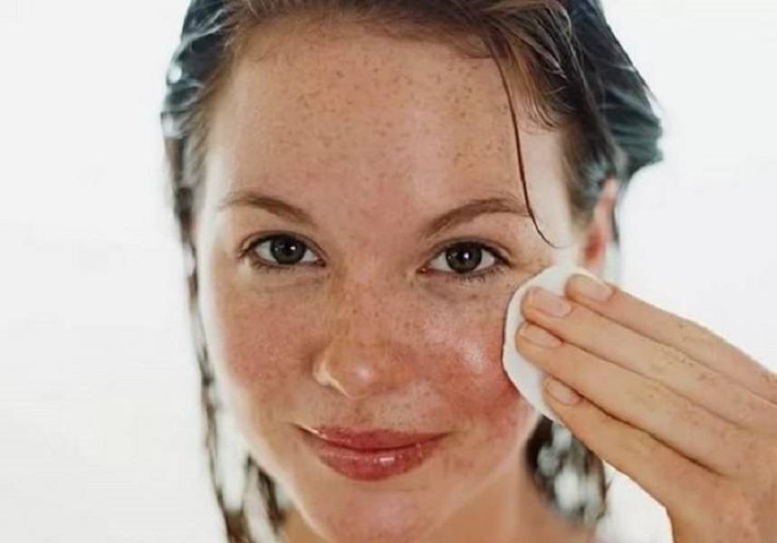 Пигментация: эффективные домашние способы осветлить кожу